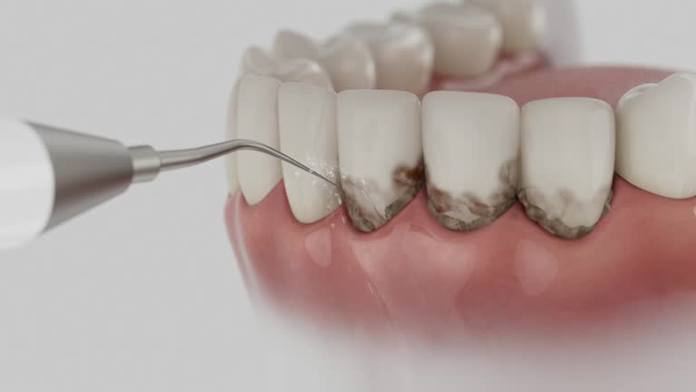 Reliable Teeth Cleaning And Checkup contractor in Allen County County, OH by Dentist Open Now